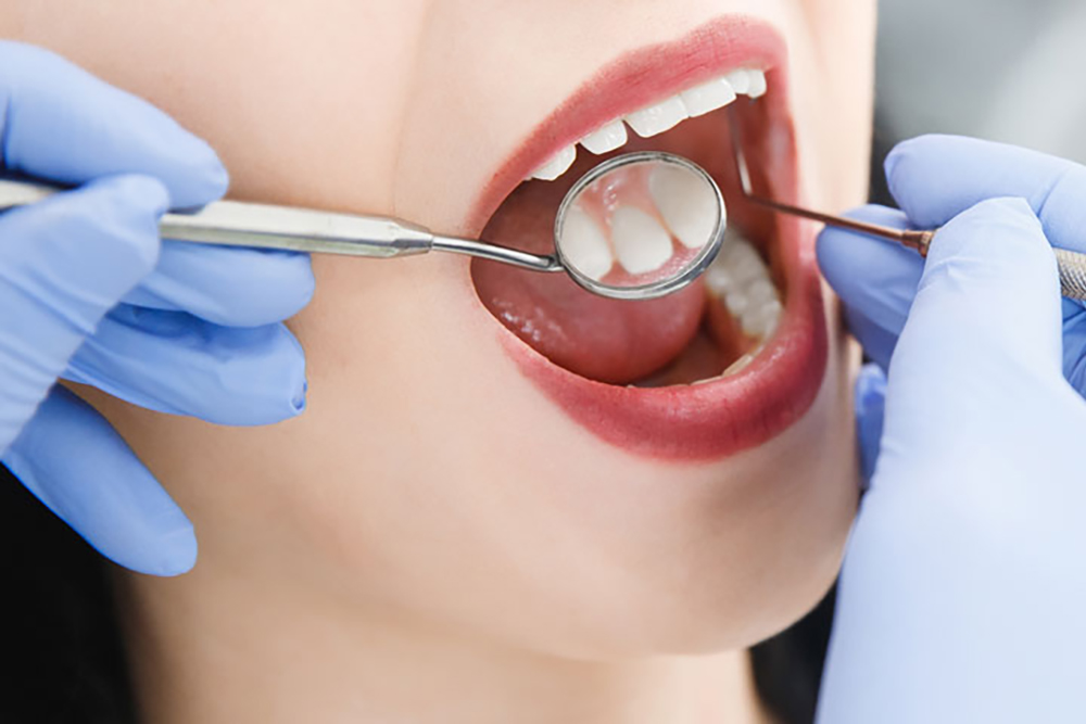 一般歯科治療の写真